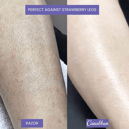 Canabban™  Hair Removal Spray