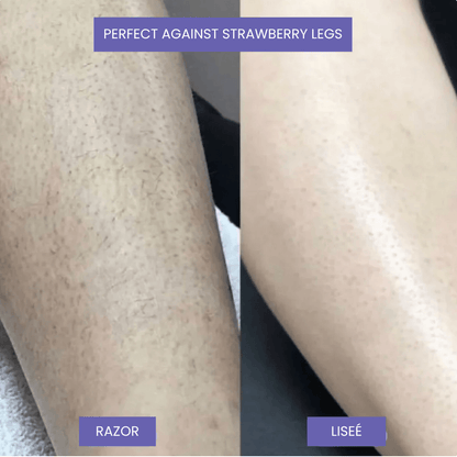 Liseé — Hair Removal Spray