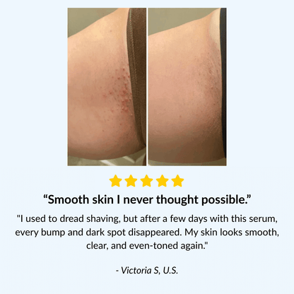 Glayde Ingrown Serum